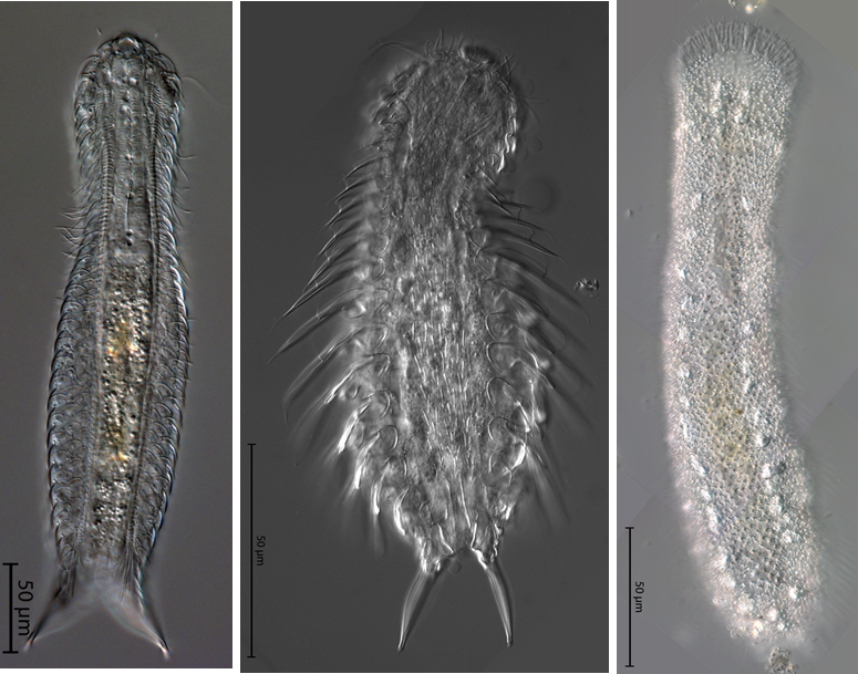 three species of Gastrotricha, a phylum within Lophotrochozoa