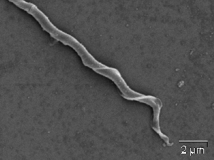 Mikroskopbilete av sperm frå lauvsongar